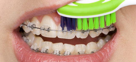 Orthodontiste à La baule, Dr Marie-Christine Huet-Malingrey
