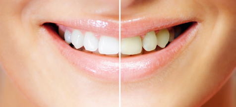 Orthodontiste à La baule, Dr Marie-Christine Huet-Malingrey
