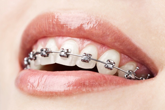 Orthodontiste à CLERMONT FERRAND, Dr Hassna NAHLI