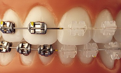 Orthodontiste à Melun, Dr AXEL AFERIAT