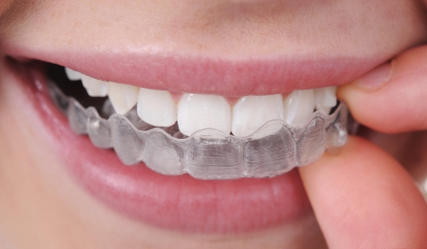 Orthodontiste à Cergy, Dr François-Joseph Nappée
